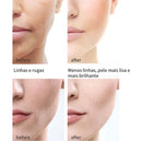 Creme Facial com Retinol e Hamamélis Hidratação, Firmeza e Iluminação da Pele